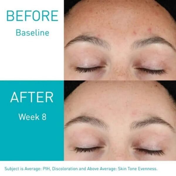 WhatsApp Image 2025-09-13 at 5.00.29 PM CeraVe Resurfacing Retinol Serum 30ml